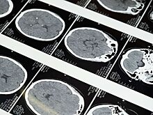 Кардио, силовые тренировки и йога: врачи объяснили, чем спорт полезен для мозга