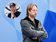 Евгений Плющенко сделал пластическую операцию: результаты, что сказала Яна Рудковская