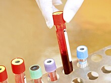 Правда и вымысел о ВИЧ