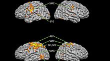 Ученые определили, какие зоны мозга участвуют в составлении и описании историй