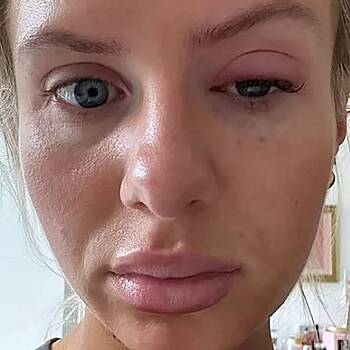 Звезда реалити-шоу показала изменение во внешности и напугала пользователей сети