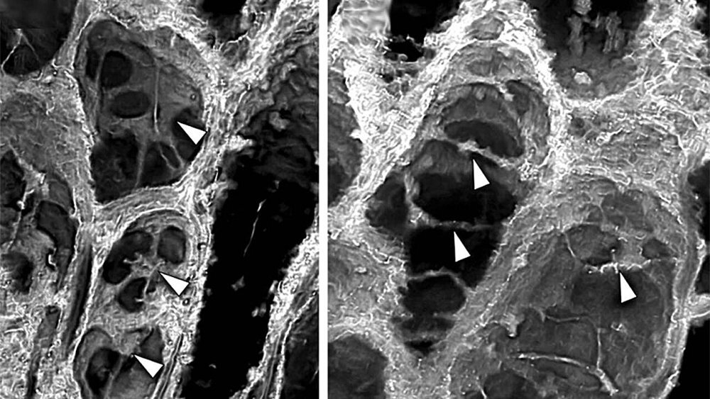 Окаменелость возрастом 407 млн лет показала, как растения стали гигантскими