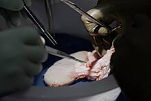 Первого пациента с пересаженной почкой свиньи выписали из больницы