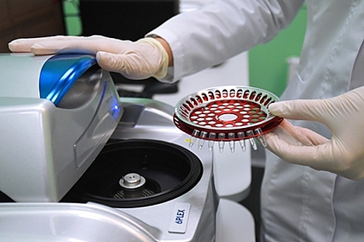 Появилась новая гипотеза о нулевом пациенте с ВИЧ