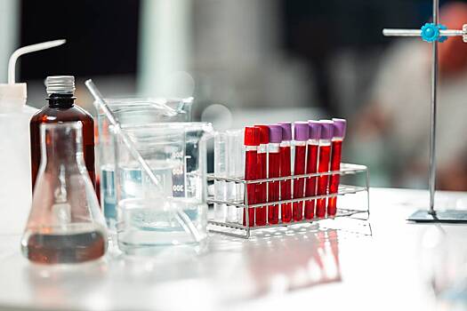 Депутатов Рады заставили сдавать анализы после массовой диареи