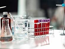 Депутатов Рады заставили сдавать анализы после массовой диареи