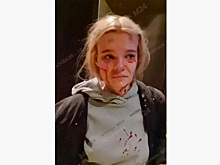 В Подмосковье россиянка потеряла сознание в лифте и очнулась в крови