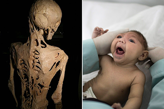 Генетический сбой: жуткие и удивительные аномалии, преследующие людей