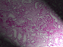 Антиоксидант SkQR1 предупреждает развитие почечной недостаточности у новорожденных