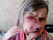 «И так скоро умрет!». Пермские врачи отказались спасать 92‐летнюю пациентку