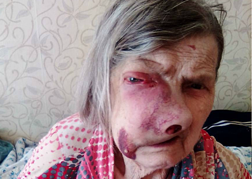 «И так скоро умрет!». Пермские врачи отказались спасать 92‐летнюю пациентку