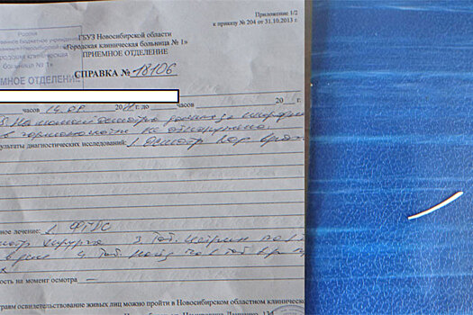 Врачи не заметили рыбную кость в горле новосибирца – СКР проводит проверку