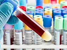 Массовое отравление произошло в детском лагере под Выборгом