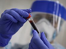 Названы пять признаков "омикрона" у привитых от COVID-19