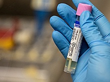 Минздрав Таиланда сообщил о 24 новых случаях заболевания оспой обезьян