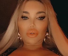 Трансгендерная «живая Барби» увеличила губы и намекнула на новую операцию