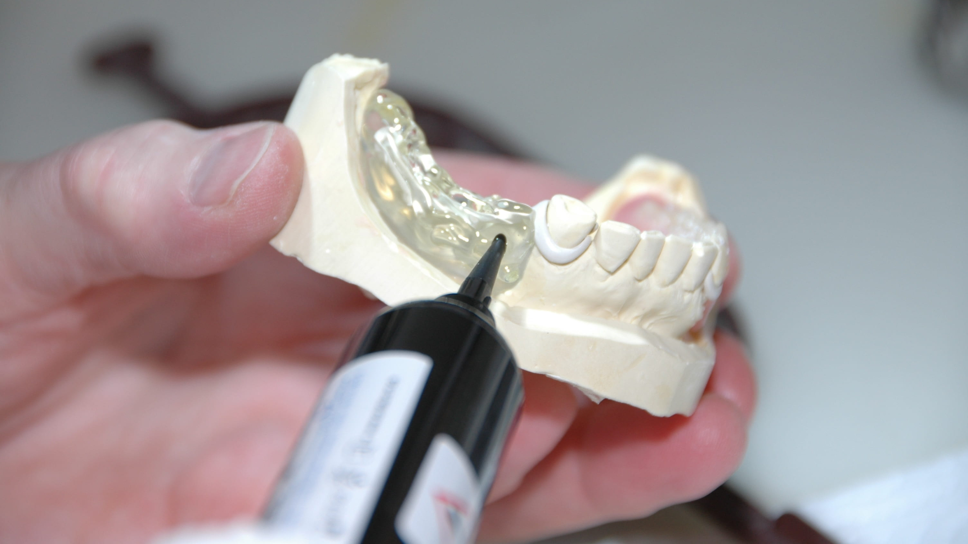Российские стоматологи разработали протез челюсти нового поколения