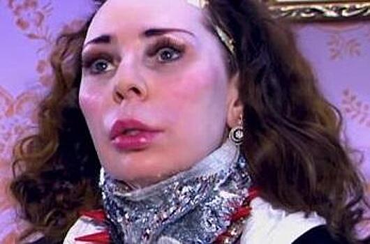 Жанна Агузарова напугала лицом после пластических операций