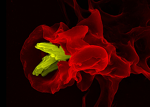 Обнаружена причина повышенного риска туберкулеза у курильщиков