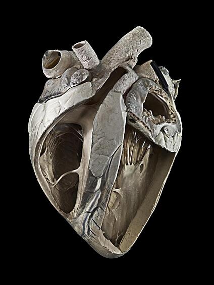 Сердце коровы, которое примерно в четыре раза больше человеческого сердца