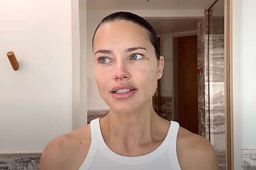 Модель Адриана Лима показала пигментные пятна без макияжа и фильтров