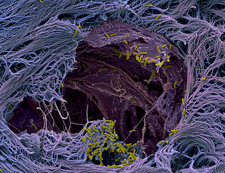 Раскрыта стратегия синегнойной палочки при заражении легких