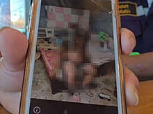 В Таиланде женщина облила мужа кислотой, пока он спал