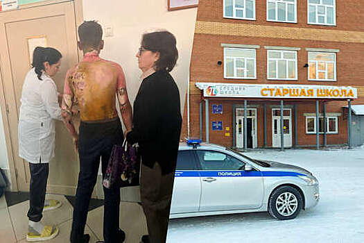 В Красноярске ученица устроила поджог в школе, пострадали пять детей