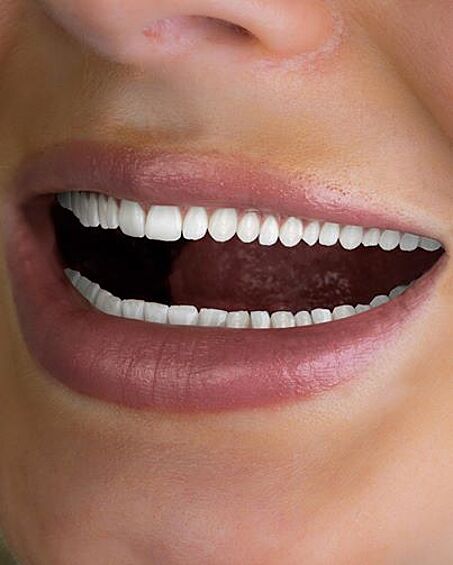 Слишком много зубов не бывает, главное, чтобы все были здоровы!