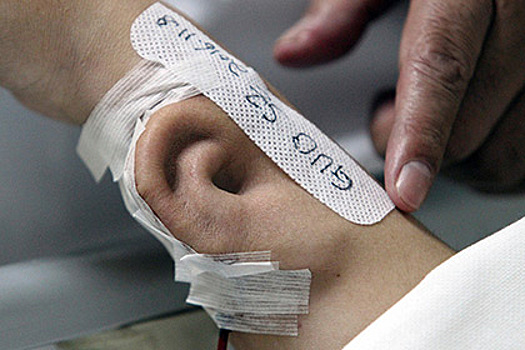 Китайские врачи вырастили ухо на руке у пациента