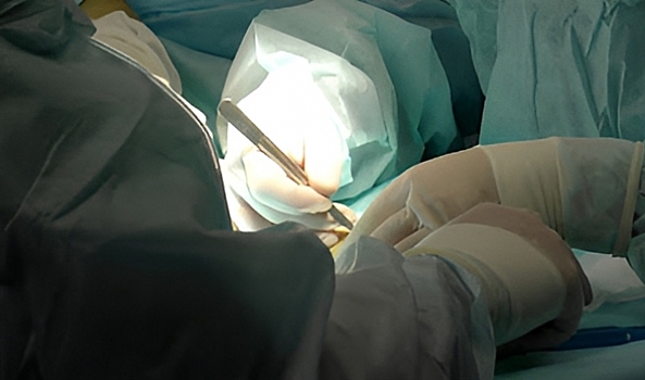 Волгоградские врачи впервые провели криоаблацию больным легочной гипертензией