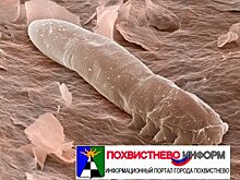 «Под кожей что-то ползает»: Самарские врачи рассказали, как защитить себя от глазного клеща