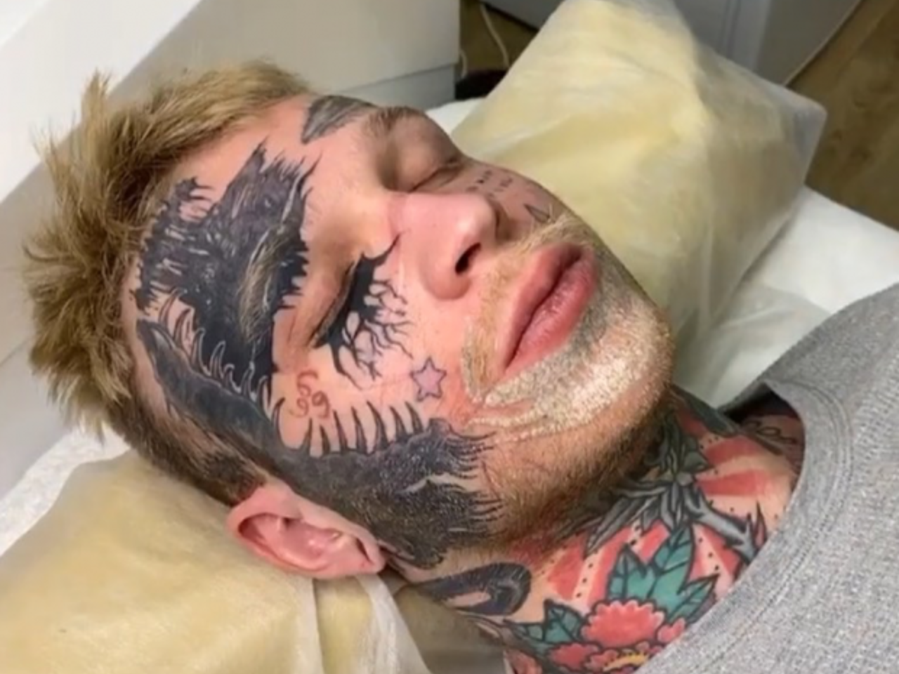 У сына Елены Яковлевой перекосилось лицо после удаления тату - Рамблер/новости