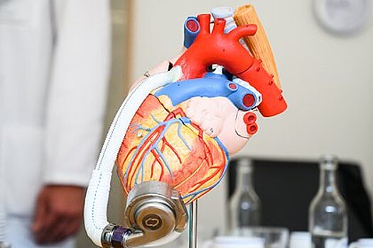 Каков риск инфаркта у пожилых во время занятий спортом