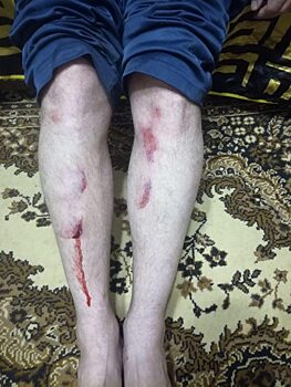 Мужчина в центре Саратова провалился в люк