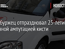 Петербуржец отпраздновал 25-летие частичной ампутацией кисти
