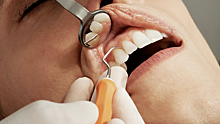 Стоматолог Лебедева: если пломба откололась, лучше как можно скорее обратиться ко врачу