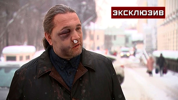 «Бил по голове, стремясь убить»: избитый экс-депутат Шингаркин подробно рассказал о нападении