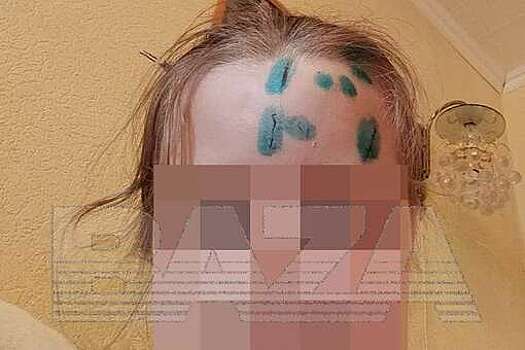 Бездомный рецидивист из Миасса искалечил девочку разбитой бутылкой