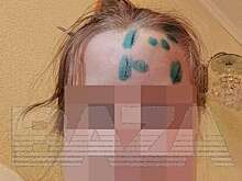 Бездомный рецидивист из Миасса искалечил девочку разбитой бутылкой