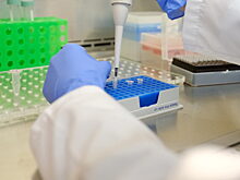 Новосибирцам угрожает смертельный птичий грипп: что известно о вирусе H5N5