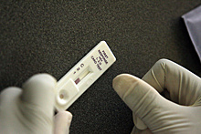 Более 1,2 млн жителей Подмосковья прошли тестирование на ВИЧ-инфекцию за январь-август