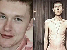 «Я знаю причину, но никогда не скажу». Мужчина из Башкирии 22 года борется с анорексией