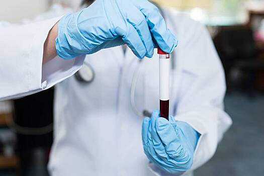 Составлен список из шести бесполезных анализов на гормоны