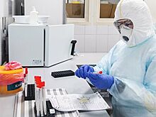 В Новосибирской области за сутки выявили коронавирус у 79 человек