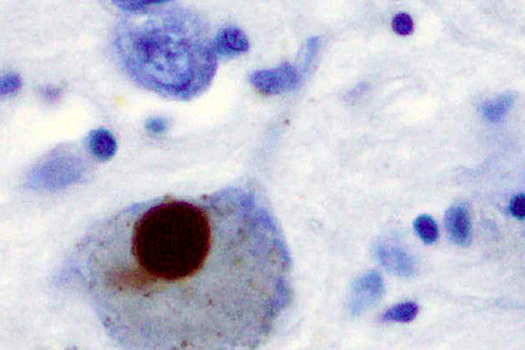 У переболевших коронавирусом мышей заметили признаки болезни Паркинсона