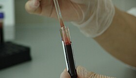 Пониженный гемоглобин: причины и методы лечения