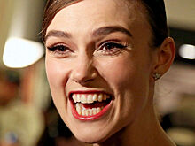 Бегом к стоматологу: звезды, у которых большие проблемы с зубами