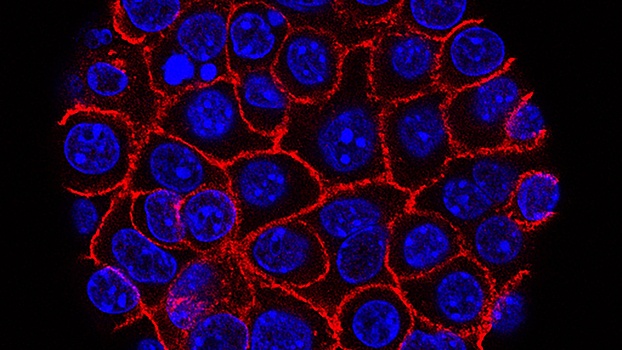 У раковых клеток обнаружили склонность к «каннибализму»