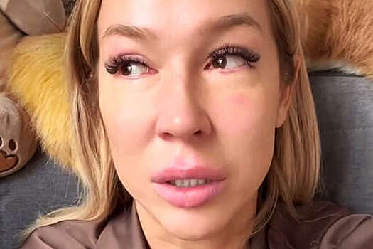 Блогерша Надежда Ермакова призналась, что упала в обморок на улице в Москве